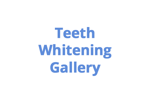 teeth-whitening-colombia-medellin-cases