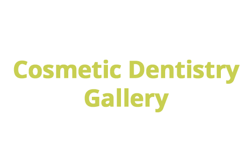 cosmetic-dentistry gallery