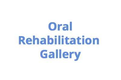 oral-rehabilitation-cases-gallery