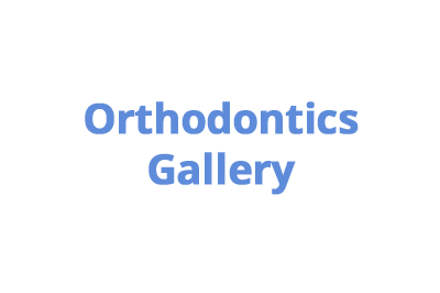 ortodontics-in-medellin-colombia-gallery