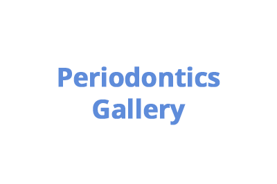 periodontist-specialist-periodontics-mouth-dental
