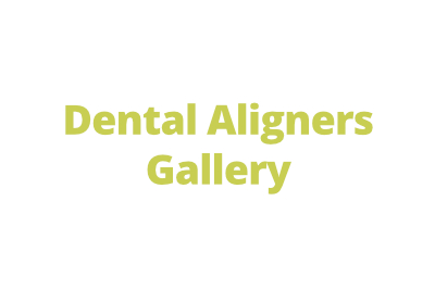 dental aligners gallery