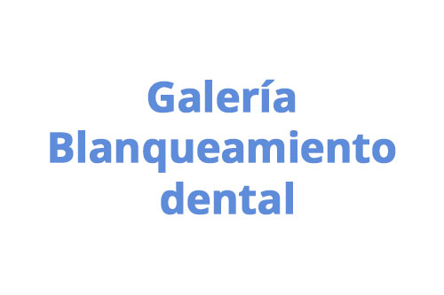 especialidad-02-blanqueamiento-dental-medellin