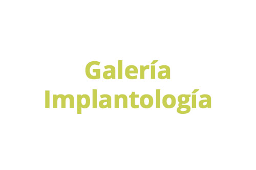 galeria implantes dentales medellin