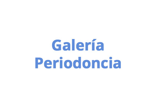 galeria periodoncia dental medellin