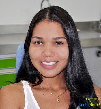 Testimonio estetica dental natalia parra