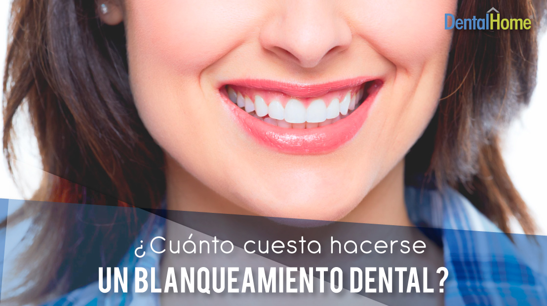 cuanto cuesta un blanqueamiento dental