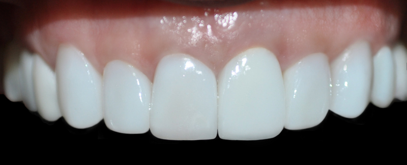 clinica implantes dentales medellin 4