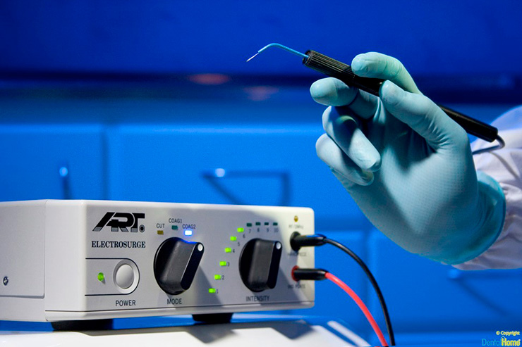 equipo electro bisturi usado en endodoncia