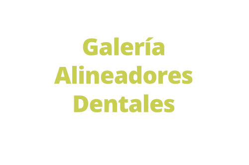 galeria alineadores dentales