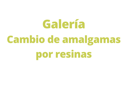 galeria cambio de amalgamas por resinas-b